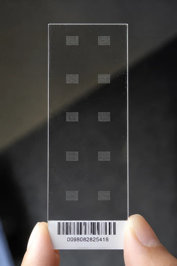 Microarray chip used in molecular diagnostics